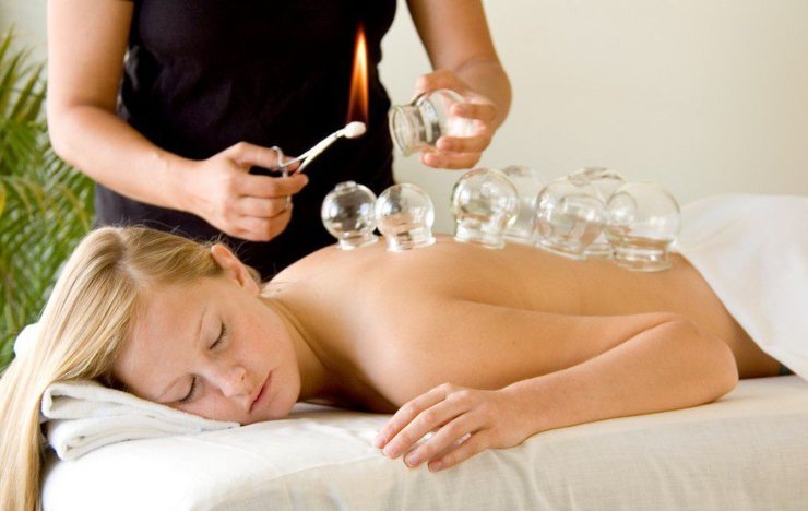 Donna terapia cupping